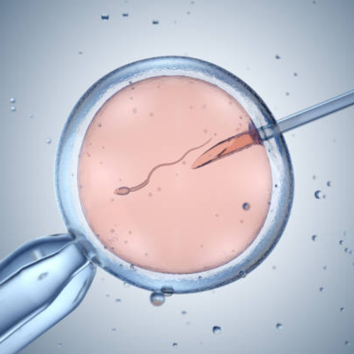 ICSI IVF Treatment