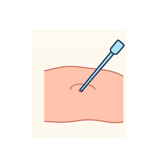 Preparation & Camera Insertion