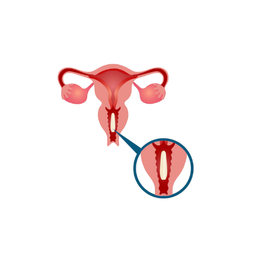Frozen Embryo Transfer (8)