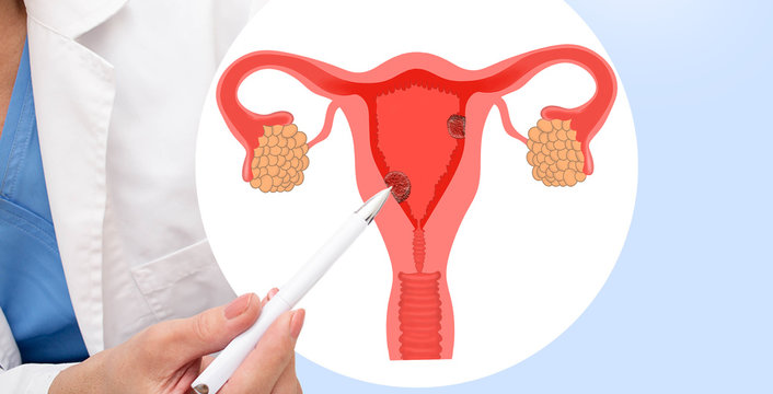 Endometrial PRP