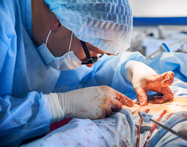 Creating Small Incisions and Inserting Instruments